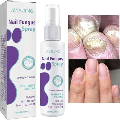 Advanced Foot and Nail Fungus Spray 100 ml